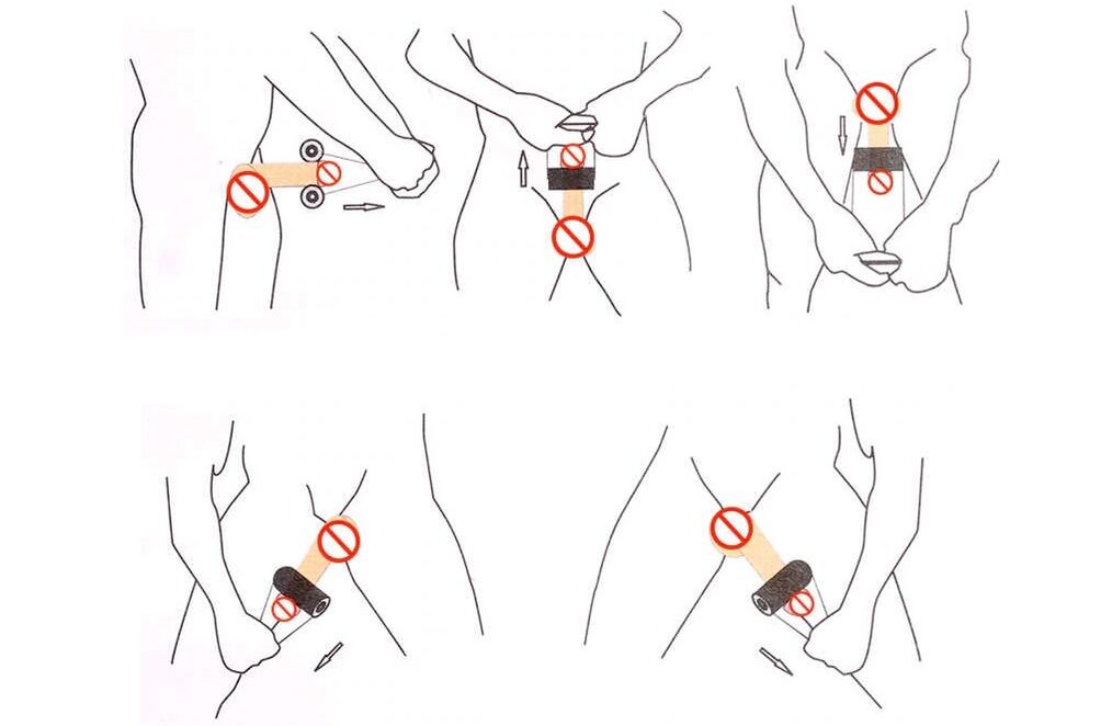 ជែលឃីងសម្រាប់ការពង្រីកលិង្គ